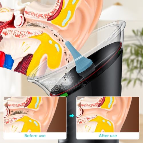 Ear Wax Removal with LED Display, Temodu Electric Ear Cleaner, Rechargeable Earwax Remove Removal Ear Irrigation System, 3 Pressure Modes Ear Cleaning Earwax Removal (Black, 12 Disposable Tips)