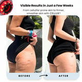 CELLUX™ Sculpt Pro
